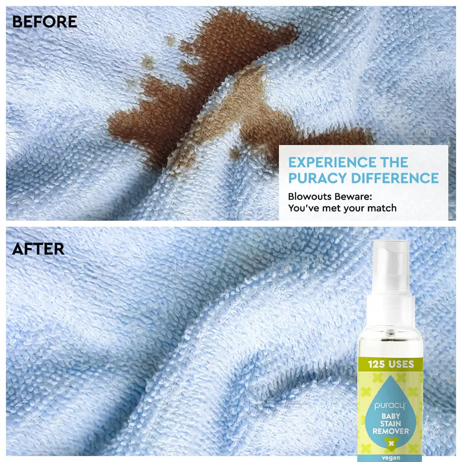 Natural Baby Stain Remover